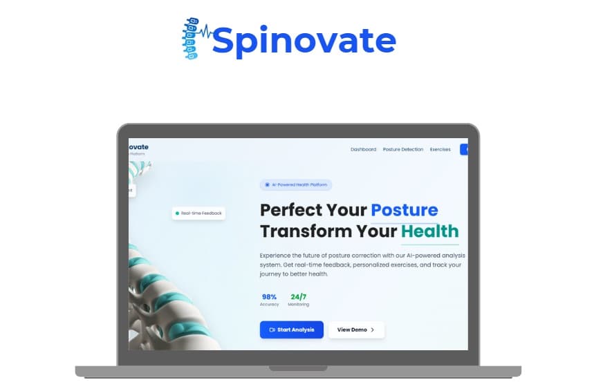 Spinovate - Watchdog for bad desk habits